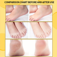 Moisturizing Foot Cream for Dry Cracked Heels