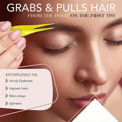 Precision Pointed Tweezers for Ingrown Hair Removal