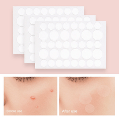 Invisible Acne Patches Hydrocolloid - Zit Cover Patches for Face