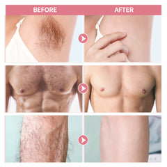 Women's Hair Removal Kit - Gentle Painless Set with Wax Paper & Cream
