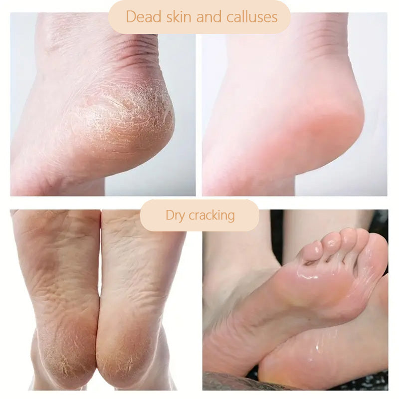 30g Hand & Foot Cream - Moisturizing Crack Repair Cream