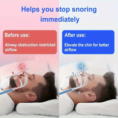 Silicone Teeth Protector for Grinding and Clenching Teeth