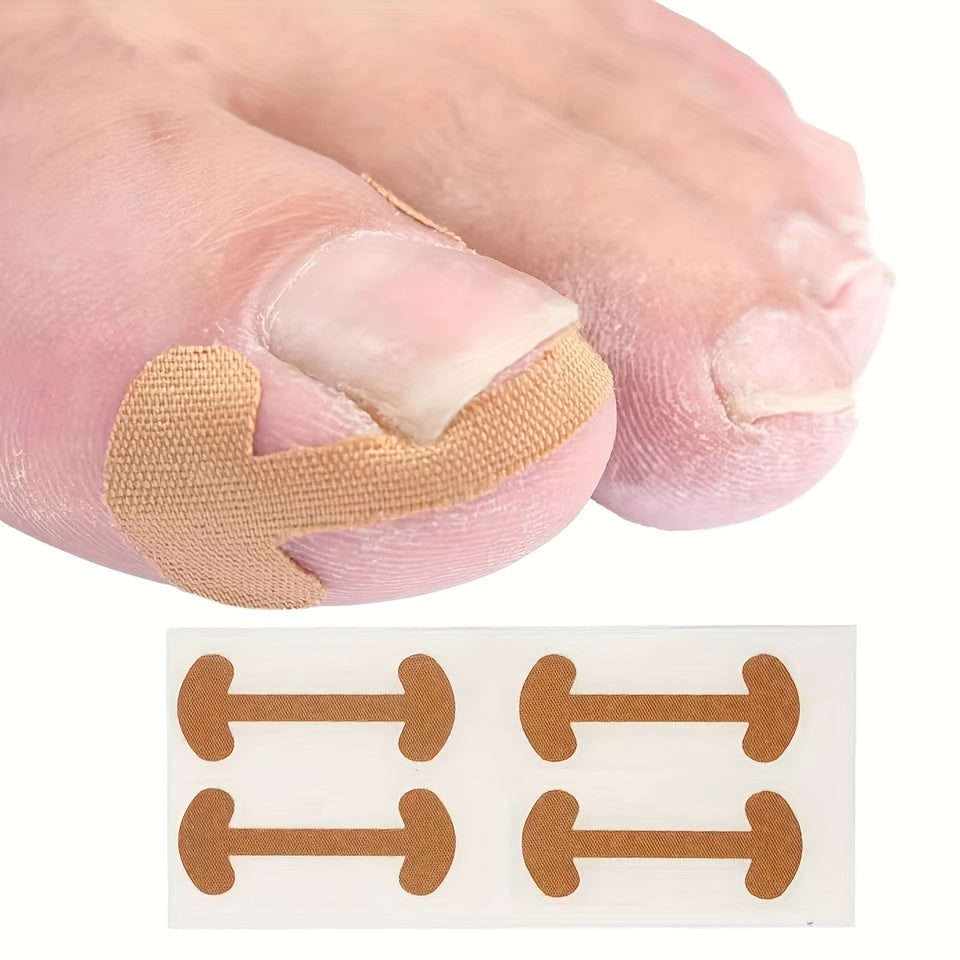 40 Toenail Correction Patches - Ingrown Nail Bone Patch - 10 Sheets
