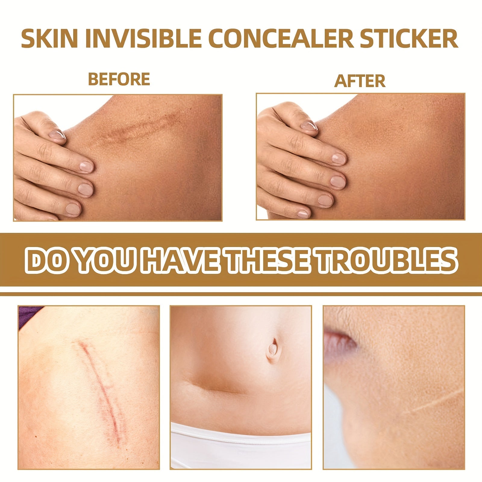 60pcs Invisible Concealer Stickers For Scars Acne Marks Waterproof Skin Tone