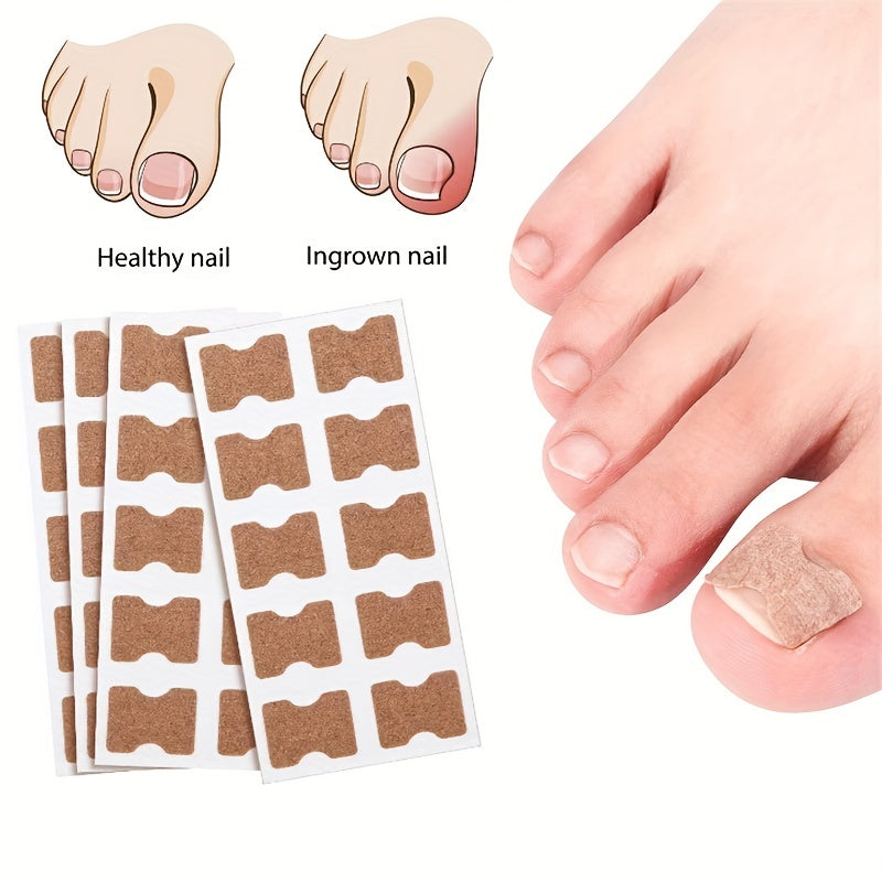 Ingrown Toenail Correction Stickers for Men and Women Foot Care Patch