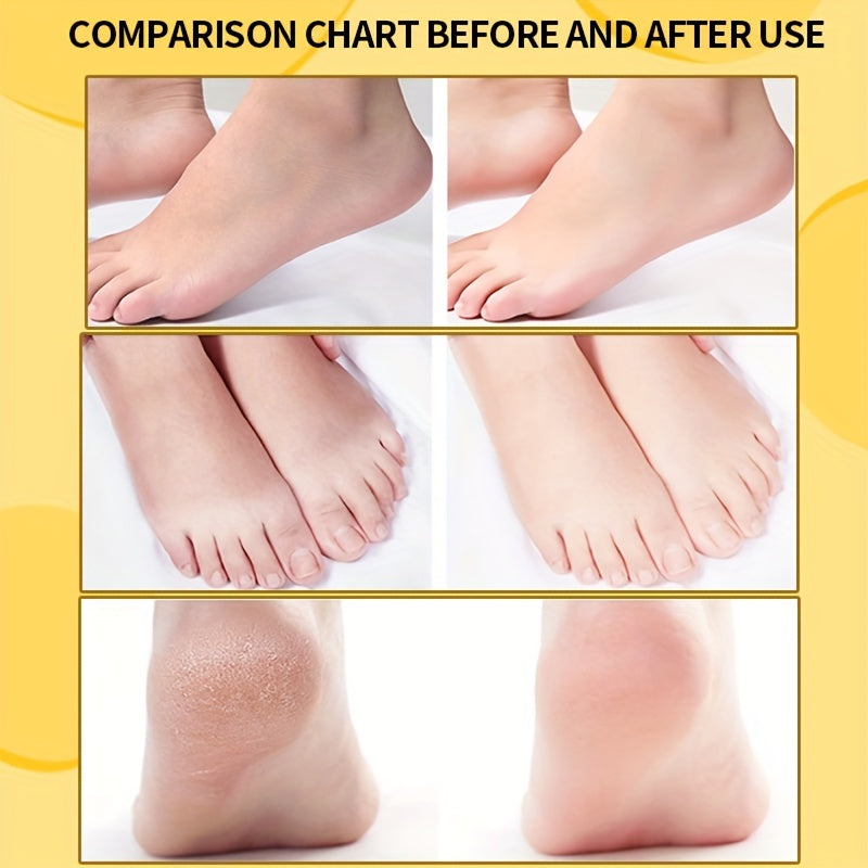 Moisturizing Foot Cream for Dry Cracked Heels