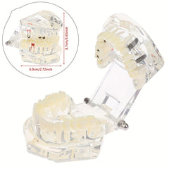 Dental Restoration Model Pathological Tooth Model Implant Tooth Model