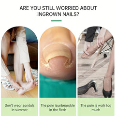 Ingrown Toenail Correction Stickers for Men and Women Foot Care Patch