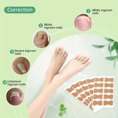 Ingrown Toenail Correction Stickers for Men and Women Foot Care Patch