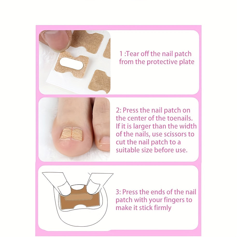 Ingrown Toenail Correction Stickers for Men and Women Foot Care Patch