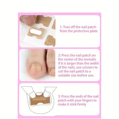 Ingrown Toenail Correction Stickers for Men and Women Foot Care Patch
