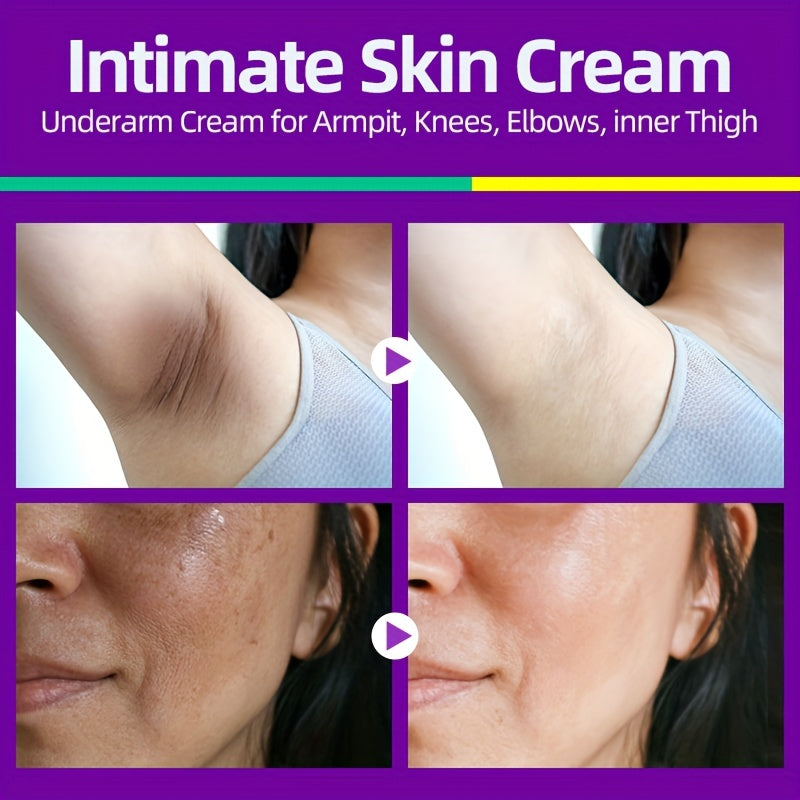 Dark Spot Removal Cream with Vit E & Niacinamide 50ml