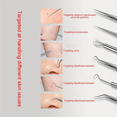 3-Piece Blackhead Remover Tweezers Set