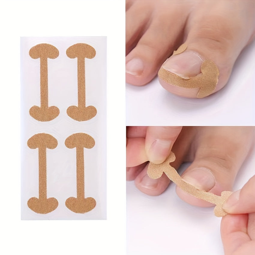 40 Toenail Correction Patches - Ingrown Nail Bone Patch - 10 Sheets