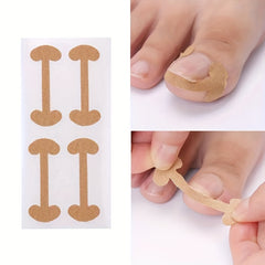 40 Toenail Correction Patches - Ingrown Nail Bone Patch - 10 Sheets