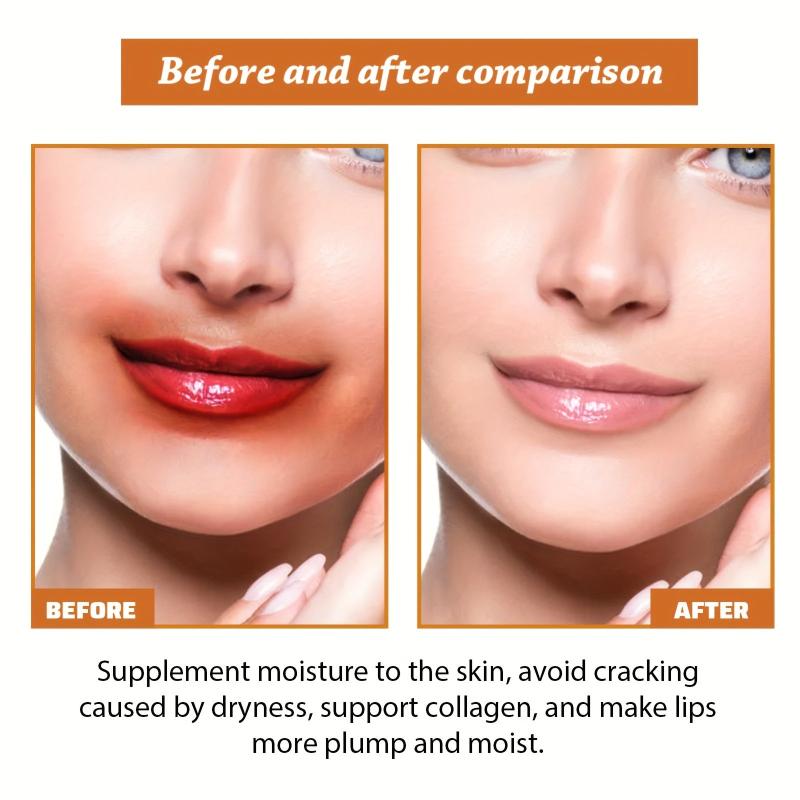 50g Pigmented Spot Lip Care Cream - Moisturizing and Repairing Formula