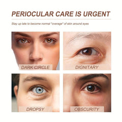 Eye Essence Fade Dark Circles Fine Lines Tighten Eyes Improve Elasticity