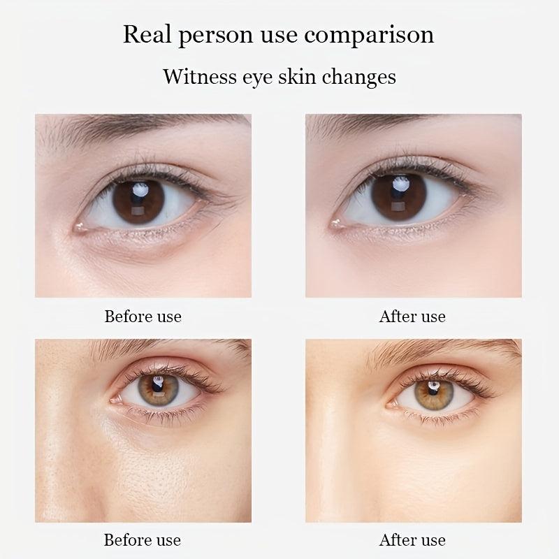 Eye Mask for Fine Lines Dark Circles Puffiness