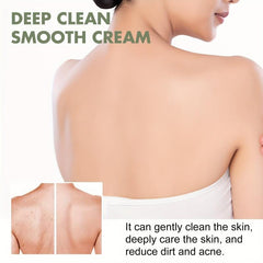 Acne Treatment Cream - Deep Cleansing & Moisturizing Exfoliator