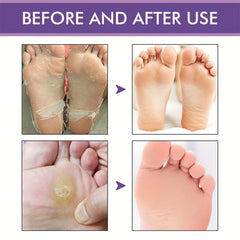 Goat Milk Exfoliating Foot Mask for Dry Feet