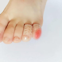 Soft Toe Protectors for Painful Toe Problems