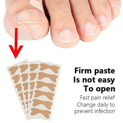 Ingrown Toenail Removal Kit Glue Patches for Pain Relief