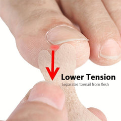 Ingrown Toenail Removal Kit Glue Patches for Pain Relief