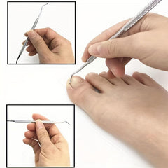 Ingrown Toe Nail Correction Tool - Paronychia Removal Tool - Pedicure Accessory