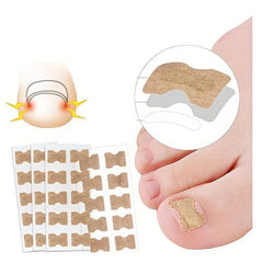 Ingrown Toenail Correction Sticker Professional Pedicure Tool