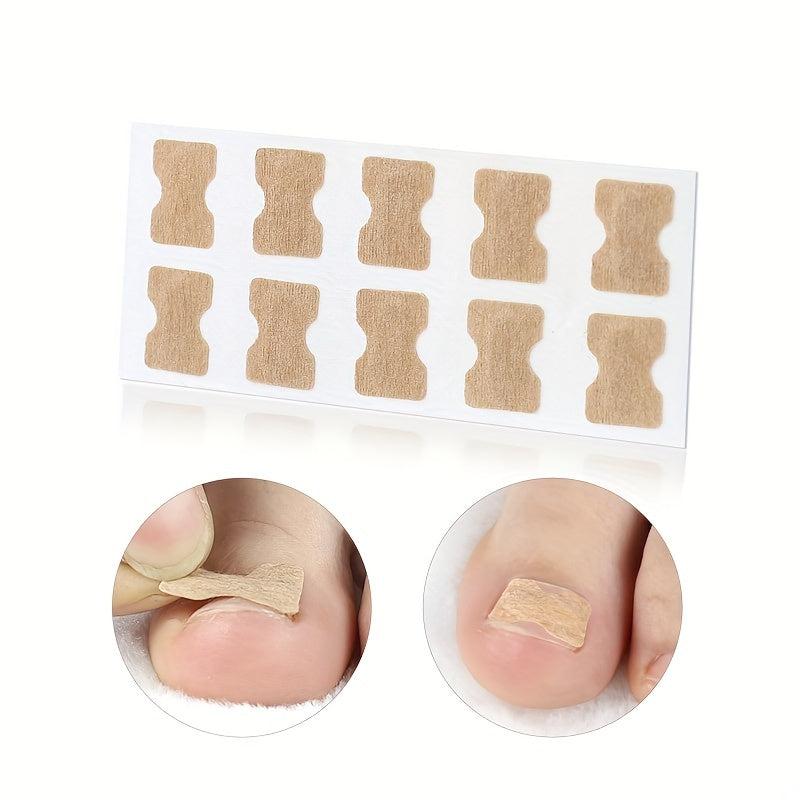 Ingrown Toenail Correction Sticker Professional Pedicure Tool