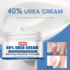 Urea Cream 30ml Foot Cream - Moisturizer for Heels, Knees, Elbows & Hands