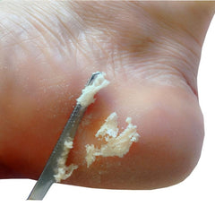 Stainless Steel Pedicure Scrapers Callus Remover Foot File