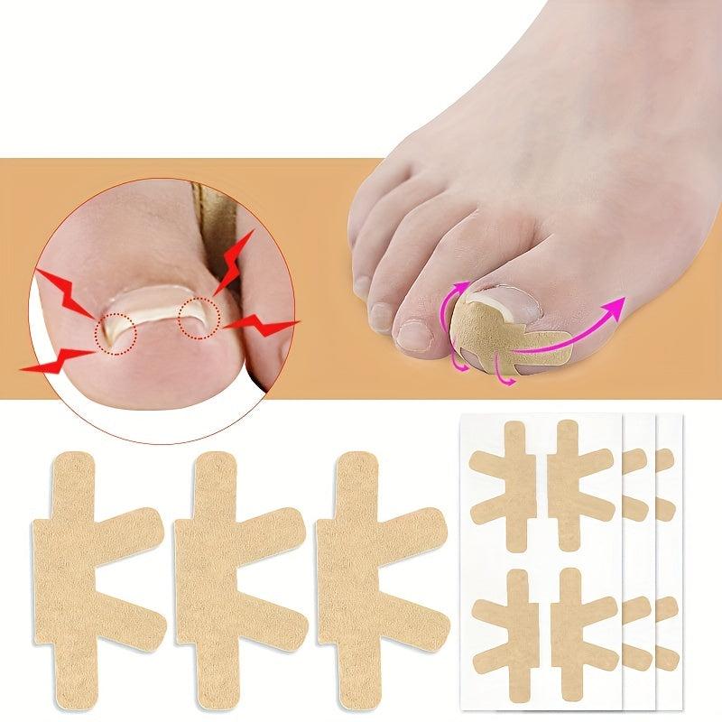 Ingrown Toenail Correction Stickers 40PCS Paronychia Toe Nail Healing