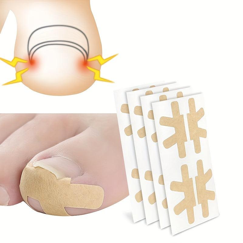 Ingrown Toenail Correction Stickers 40PCS Paronychia Toe Nail Healing