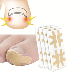 Ingrown Toenail Correction Stickers 40PCS Paronychia Toe Nail Healing