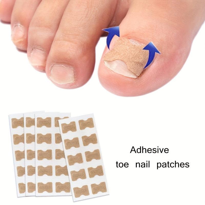 10pcs Ingrown Toenail Correction Strips Painless Pedicure Patch