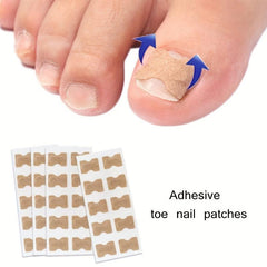 10pcs Ingrown Toenail Correction Strips Painless Pedicure Patch