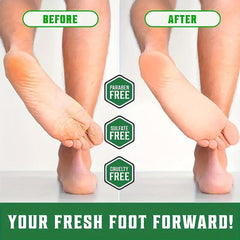 50g Honeysuckle Foot Cream for Dry Cracked Heels with Tea Tree Oil & Calendula