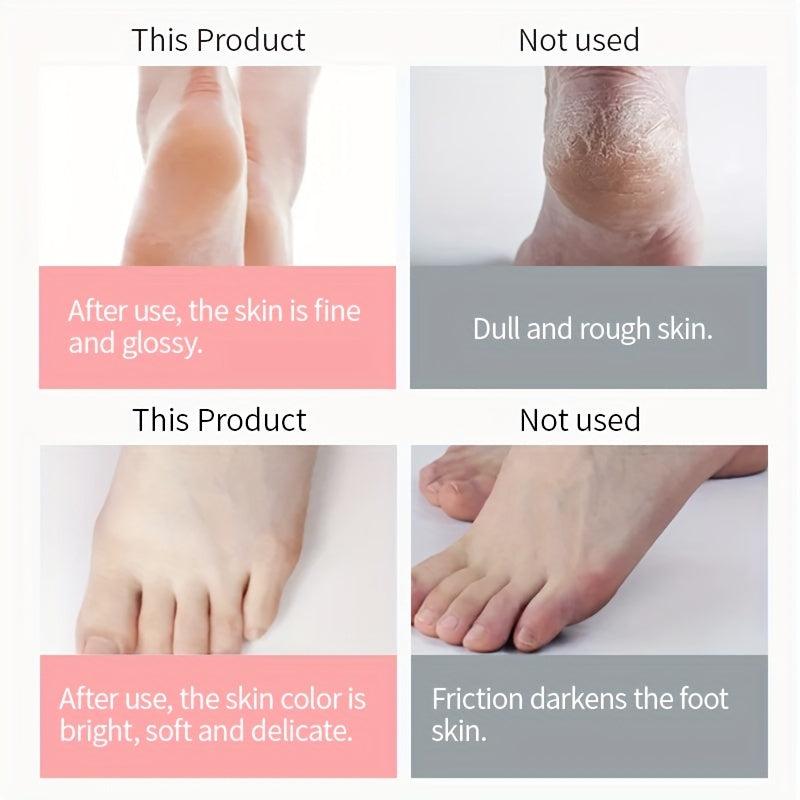 Urea Foot Cream for Dry Cracked Skin - Moisturize and Nourish Your Feet