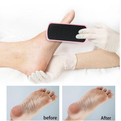 Double Sided Colossal Foot Rasp Callus Remover