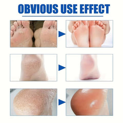 Lavender Foot Cream for Dry Cracked Feet - Nourishing Foot Moisturizer