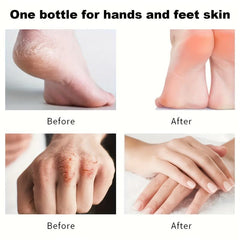 5 Pcs Litchi Hand Cream - Deeply Moisturizing and Nourishing Hand Lotion