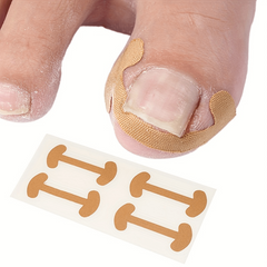 20pcs Ingrown Nail Correction Patch Toenail Corrector Repair Deformation