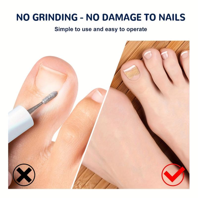 Ingrown Toenail Correction Stickers Nail Corrector Patches