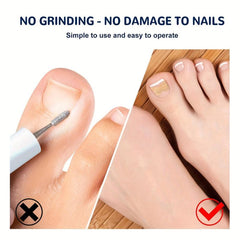 Ingrown Toenail Correction Stickers Nail Corrector Patches