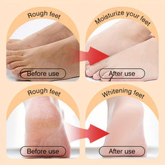 Dry Skin Care Cream - Soften, Remove Dead Skin - Moisturize & Nourish