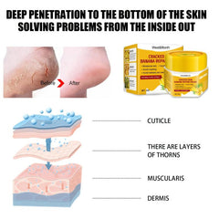 Banana Foot Cream for Dry Cracked Feet, Heel Moisturizer