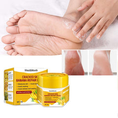 Banana Foot Cream for Dry Cracked Feet, Heel Moisturizer