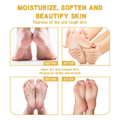 Moisturizing Foot Cream for Dry Cracked Skin