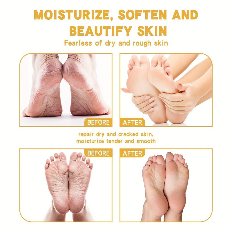 Moisturizing Foot Cream for Dry Cracked Feet - Nourishing Hydrating Skin Care